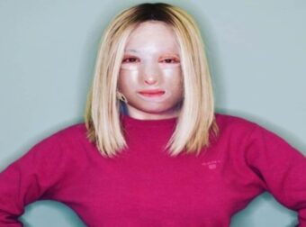 Ιωάννα Παλιοσπύρου: Δείχνει για πρώτη φορά το πρόσωπό της μετά την επίθεση με βιτριόλι – Ελλάδα