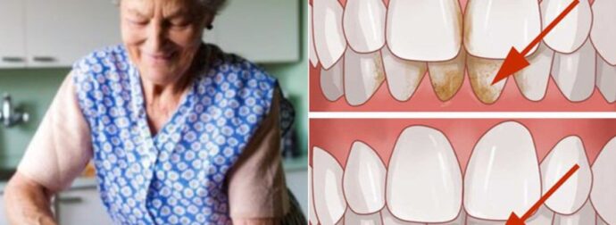 Πέτρα Δοντιών: Το απλό κόλπο της γιαγιάς που είναι χρήσιμο και στις μέρες μας