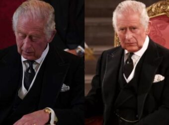 Παγκόσμια ανησυχία τωρα για το Βασιλιά Κάρολο: Γιατί όλοι σχολιάζουν τα χέρια του-απο τί πάσχει