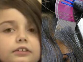 Θλίψη: Νεκρή 12χρονη από ψείρες που της ήπιαν όλο το αίμα – Συνελήφθησαν οι γονείς (photos-video) – Κόσμος